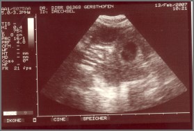 Ultraschallbild vom O-Wurf